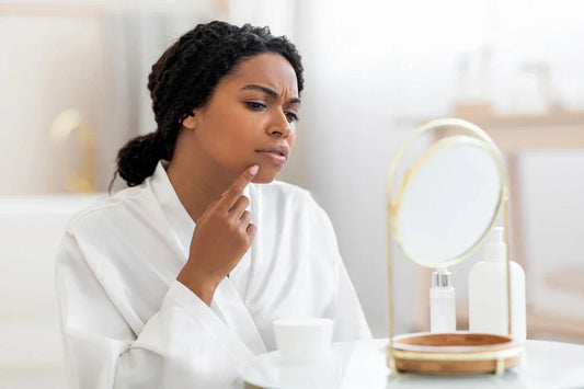 What is Acne?